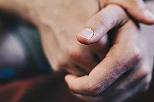 Can You Get Cold Sores on Fingers (Herpetic whitlow)?