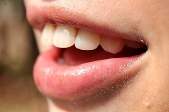 Why Did My Cold Sore Scab Turn Black?