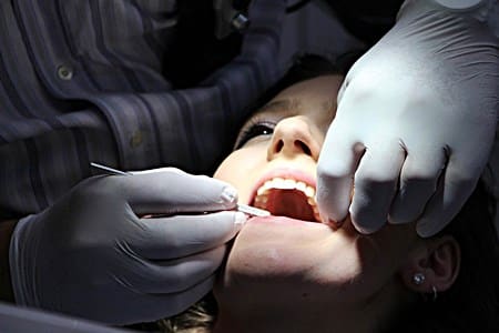 Danger of cold sores after getting work on teeth
